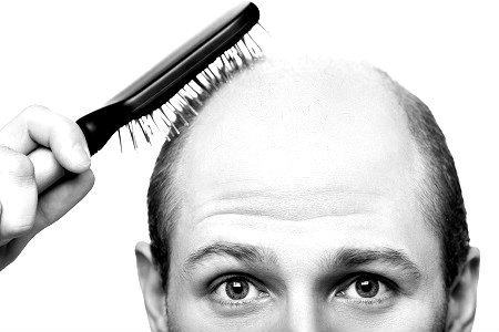 Los remedios naturales elaborados con plantas medicinales pueden ayudar a frenar la caída del cabello